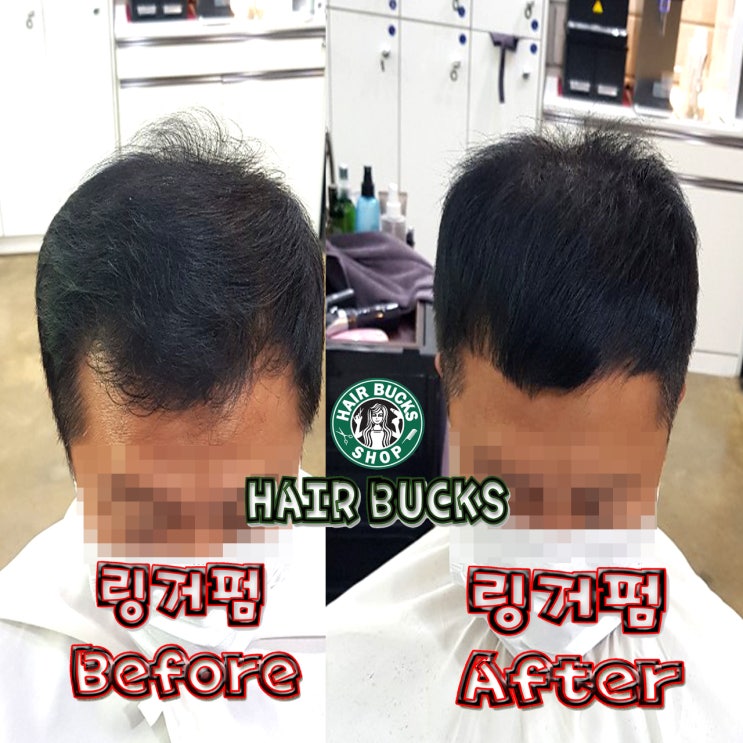  컷트하시면서 간단하게 링거펌시술하기 !! 수원정자동미용실 링거펌전문점 헤어벅스