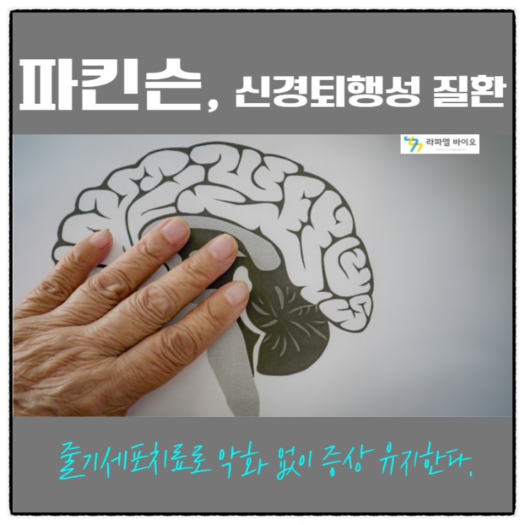  파킨슨, 신경퇴행성 질환 줄기세포치료로 한다.