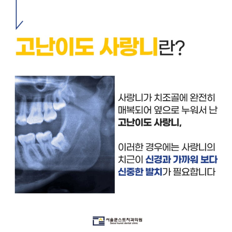  광교사랑니발치에 대해 알아볼까요?