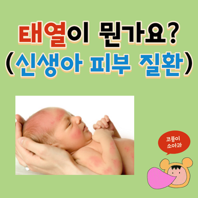  신생아 태열이 뭔가요?(신생아 피부 질환, 비판텐, 수딩젤)