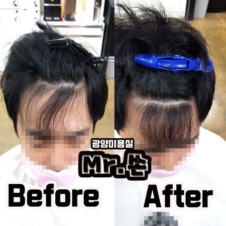  앞머리 모류교정 링거펌 후기 ! ! ! 광양미용실 중마동미용실 링거펌전문점 미스터쏜