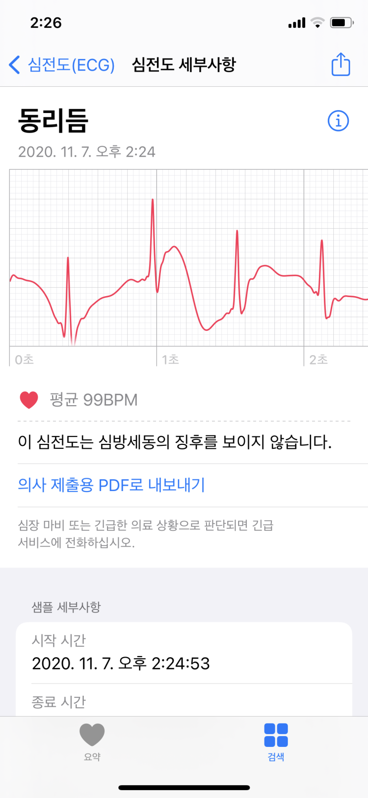  애플워치 심전도앱 활성화! watchOS 7.1 & iOS 14.2 필요, 활성화 실패 시 OS 버전을 꼭 확인하세요! | 알쓸리뷰X테크