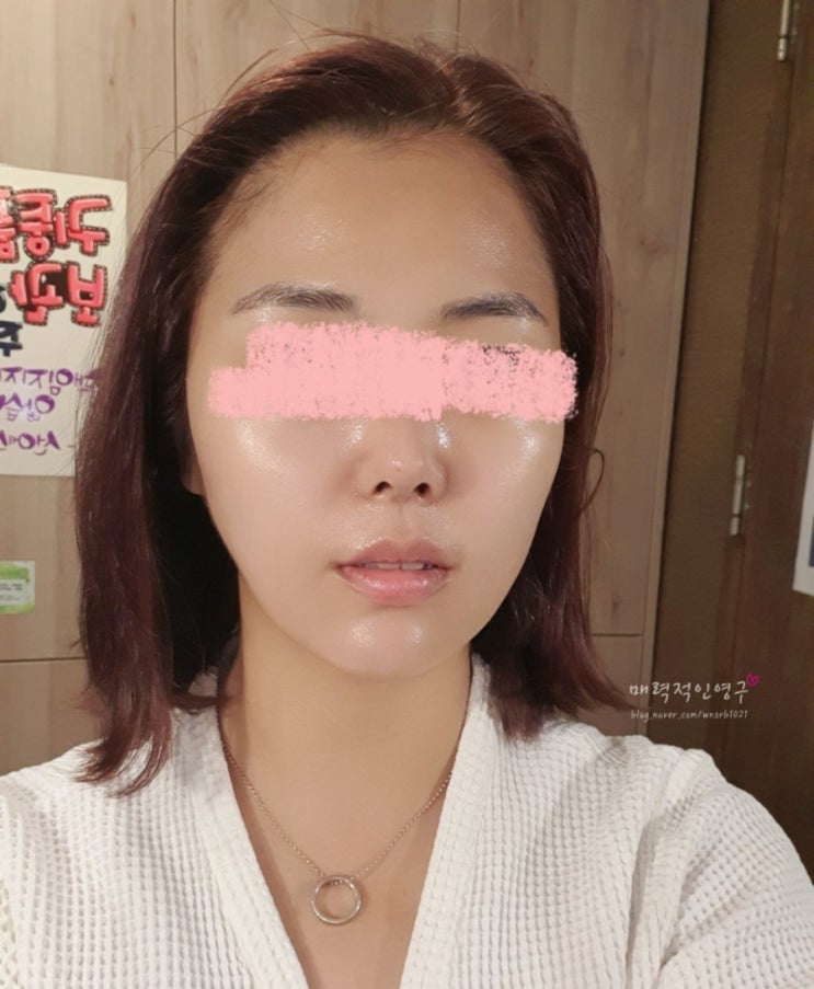  강남 선릉역 피부관리실 선에스테스파 선릉점 울트라 볼륨업 4D 후기