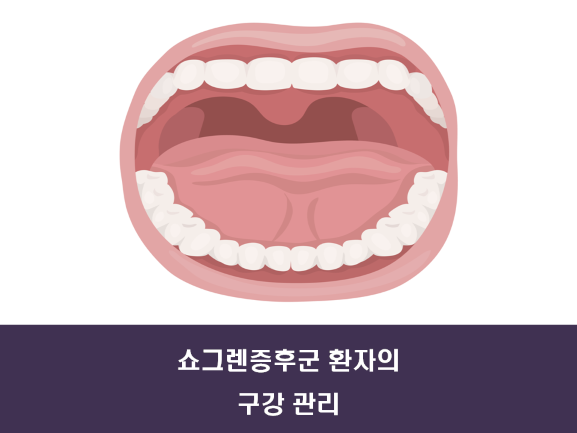구갈증이 나타나는 '쇼그렌증후군' 구강관리법