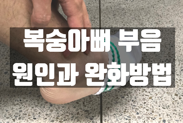  복숭아뼈 부음 증상 이유 무엇일까?