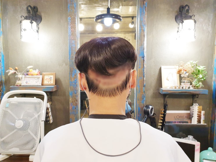  모발이식 후 뒷머리 가렸어요