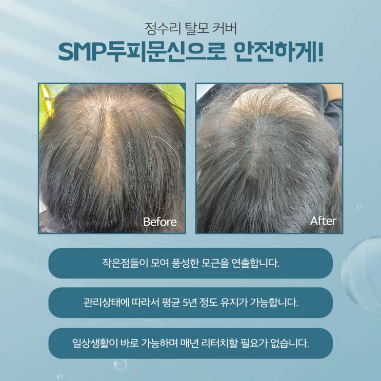  김해두피문신 만족스런 이유