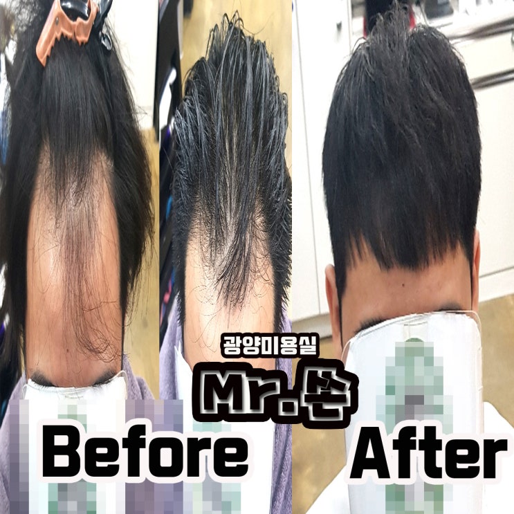  군대 전역후 부터 머리가 계속 빠지시는 고객님... 미스터쏜에서 고민해결 해드렸습니다 !! 광양미용실 중마동미용실 링거펌전문  미스터쏜