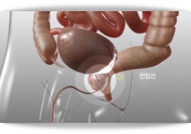  전립선암 증상 및 원인