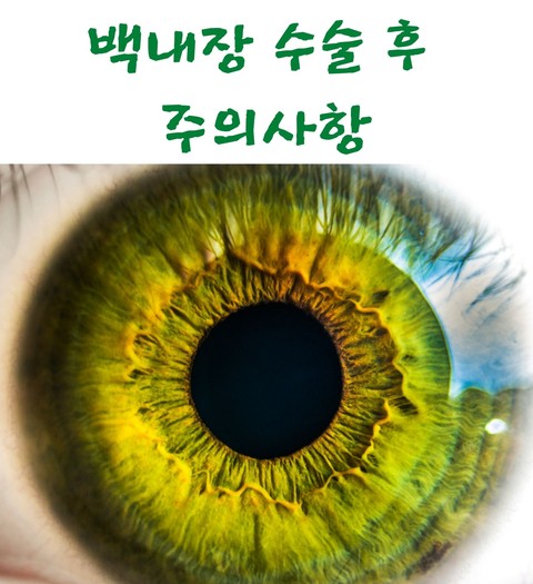 백내장 수술 후 주의사항