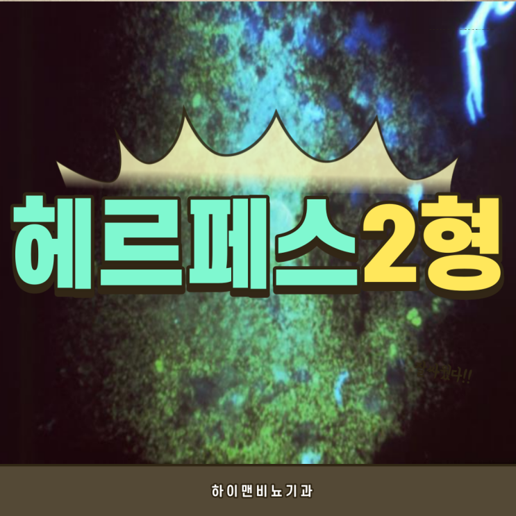  여자 헤르페스 2형 증상과 사진 완치는 되나요?