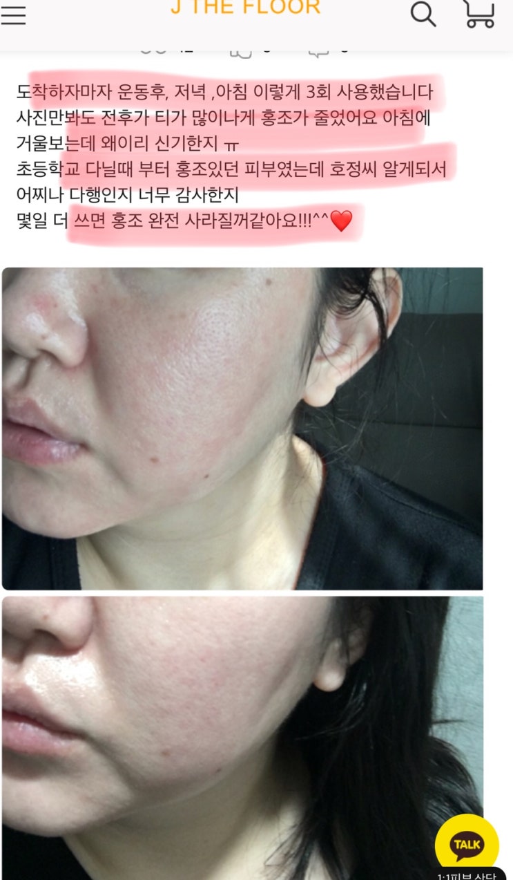  제플이 직접 컨택한 매드스킨케어 델리케이트 홍조세럼 후기 “또 도착” 핫딜 곧 마감 서두르세요>_<
