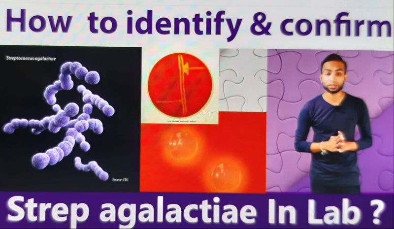 Streptococcus agalactiae, B군 연쇄상구균에 대하여 : 네이버 블로그