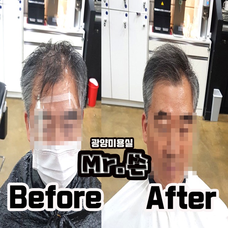  머리가 숱이없어... 옆으로 퍼지시는 고객님 모류 교정 후기 ! ! 링거펌 전문점 미스터쏜