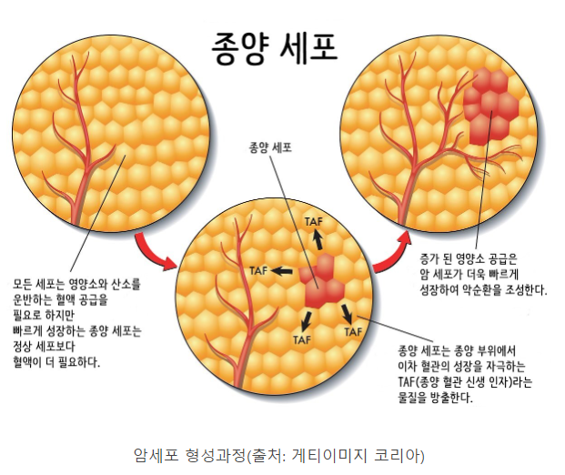  암은 왜 생기는 걸까요?