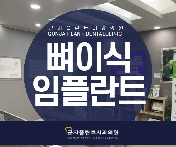 답십리치과, 뼈이식임플란트 고민 자가혈 PRF 시술로 회복 기간도 단축해요 답십리치과, 뼈이식임플란트 고민 자가혈 PRF 시술로 회복 기간도 단축해요
