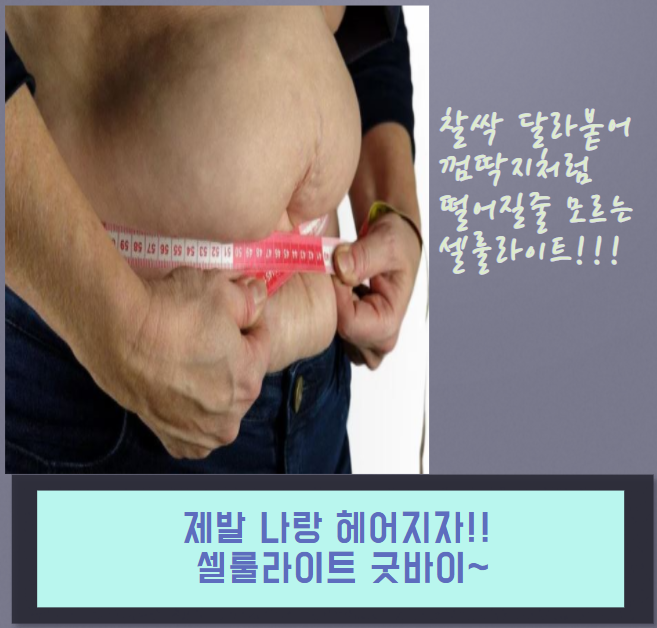  내 몸과 이별을 모르는 셀룰라이트!! 빨리 헤어지는 방법!!