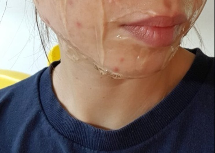  너무 슬퍼요.. 오늘 문제성피부 전문 미국 에스테틱 브랜드 매드스킨케어 델리케이트 마감 이예요! Hurry up 
