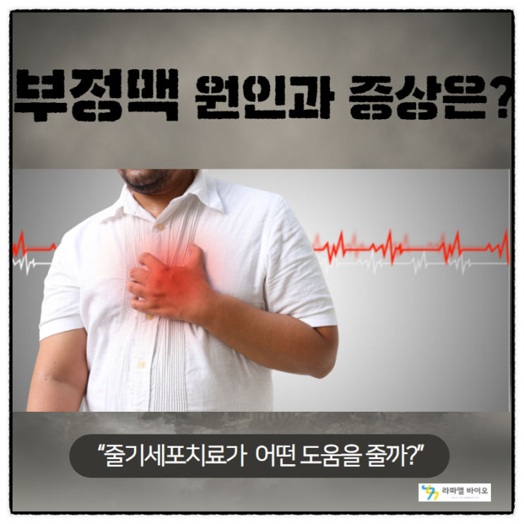  부정맥 원인과 증상은? 줄기세포치료가 어떤 도움을줄수 있을까?