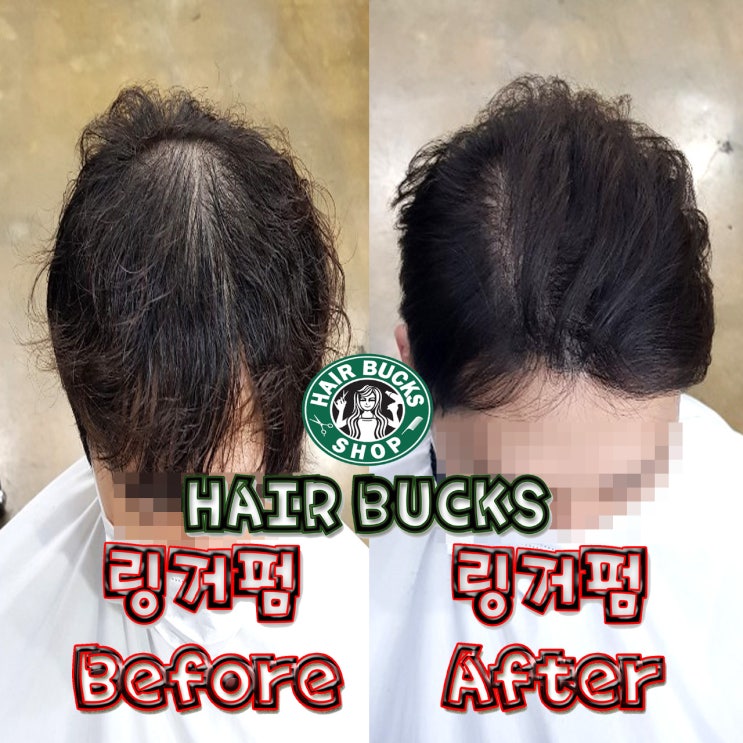  히든펌 시술받으신 고객님 링거펌 시술받으시고 만족도 200%