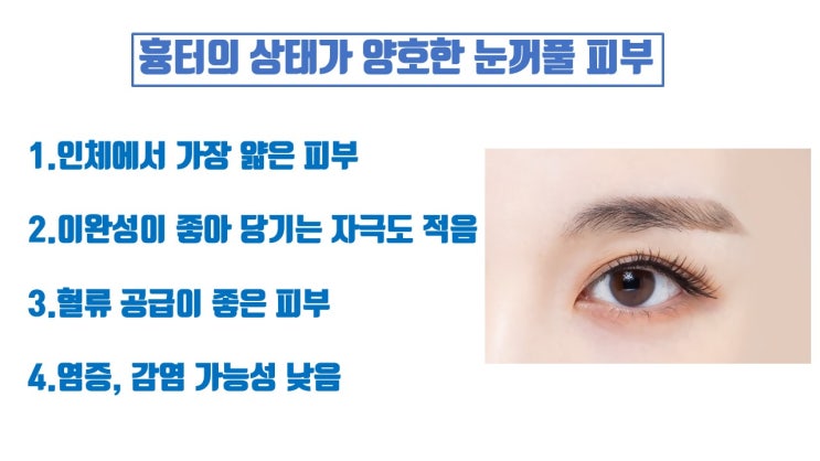  쌍수흉터연고 발라도 쌍수흉터에 별 도움 안되요 ㅠㅠ