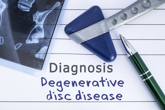퇴행성디스크(degenerative disc),요추   추간판탈출증(허리디스크) 증상과 예방운동 알아보자