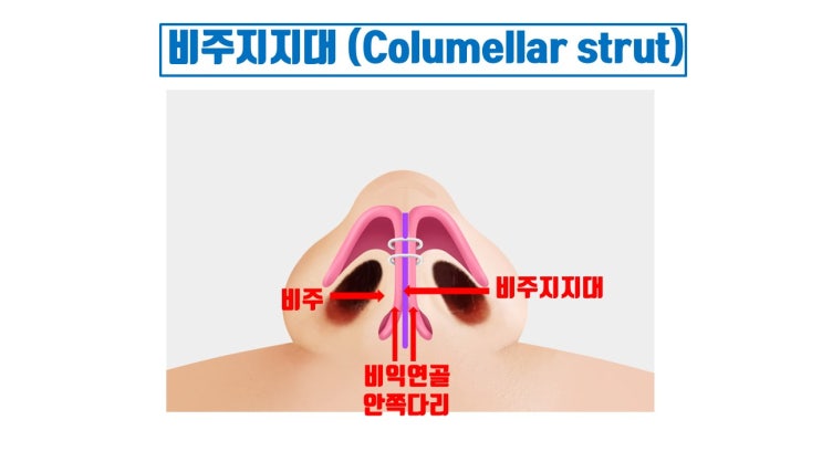  비주 지지 없이는 코끝성형 절대로 유지 안됨 !!!