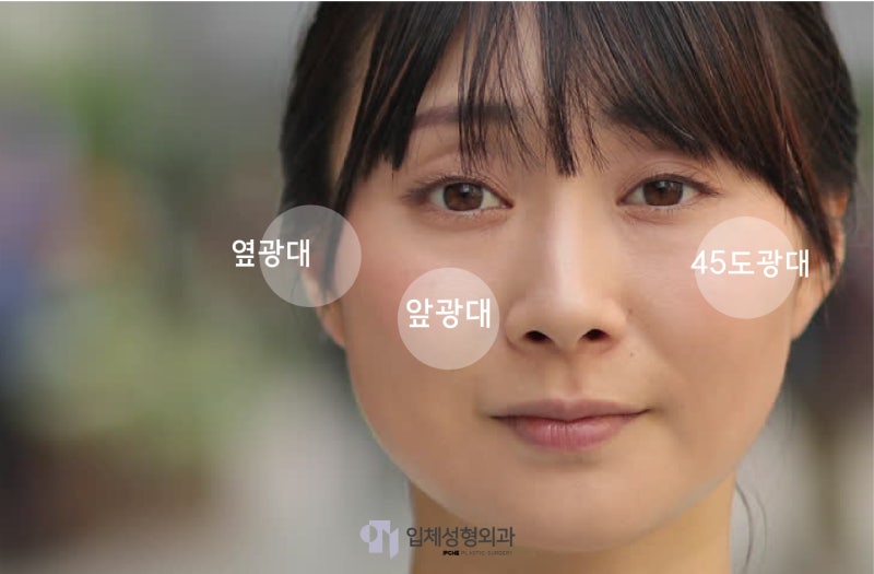 입체성형외과] 옆광대, 45도광대축소 부위별로 수술방법이 달라진다구? : 네이버 블로그