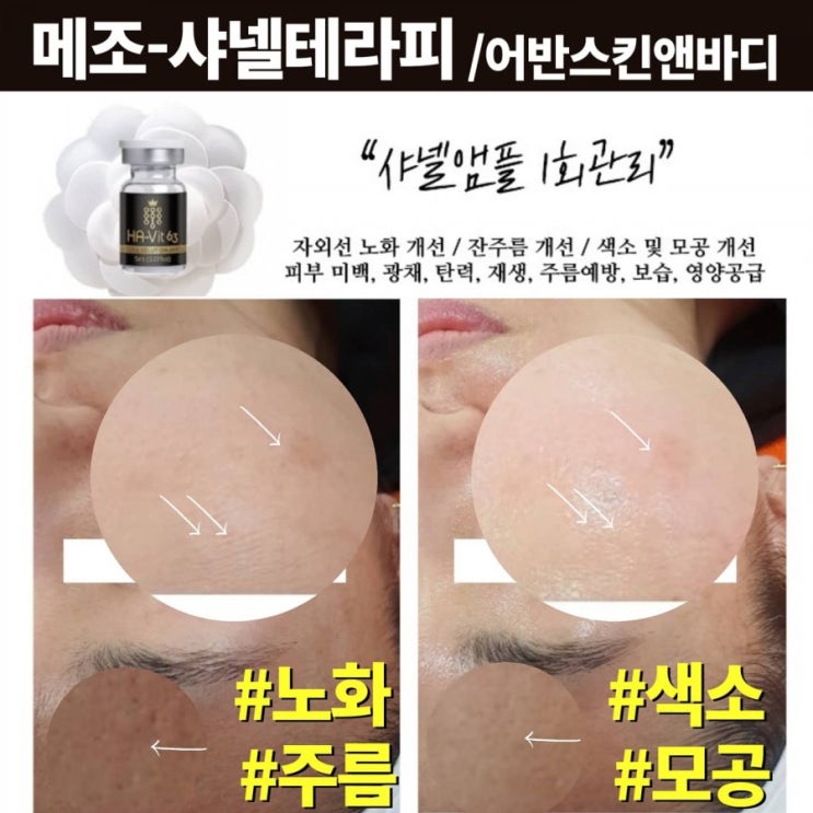  부산 대연동 최초 진짜 찐사넬앰플 공식입점