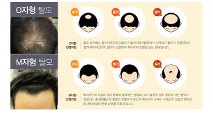 모발구조 탈모영양소결핍 머리카락주기수명: 아연 이노시톨 msm 맥주효모 효능권장량주의사항 모발구조 탈모영양소결핍 머리카락주기수명: 아연 이노시톨 msm 맥주효모 효능권장량주의사항