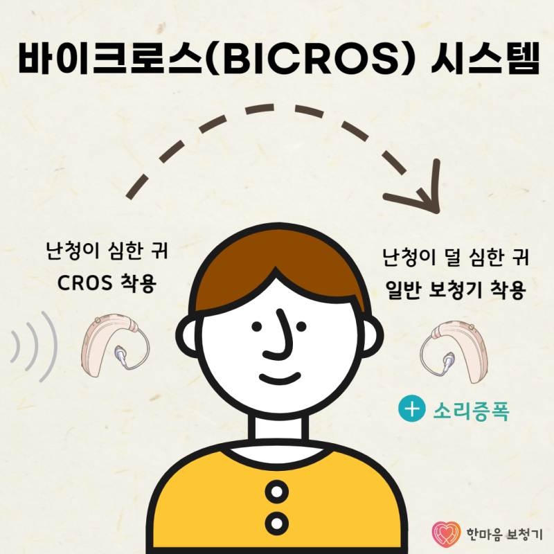 [리사운드 보청기] 편측성 난청, 한쪽 귀 안 들릴 땐 어떤 보청기 착용해야 할까? 6