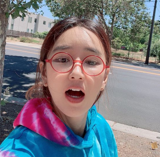 윤현숙 양악 수술 전후 근황 윤현숙 양악 수술 전후 근황
