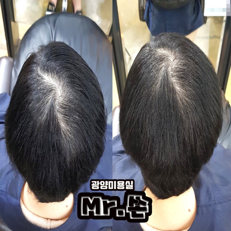  비어보이는 뒷통수 ! 힘없고 갈라지는머리 ! 미스터쏜에서 잡아드리겠습니다 ㅎㅎ