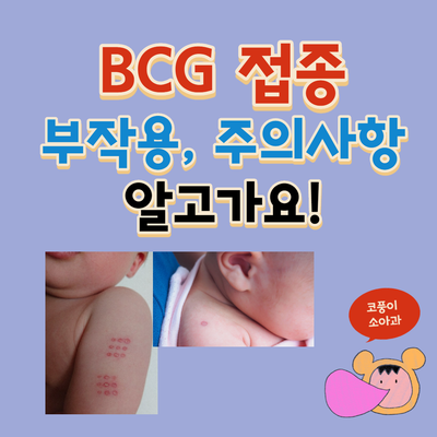  BCG 접종 부작용, 주의사항 알고가요!(고름, 림프절염, 재접종)