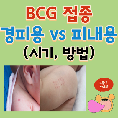  신생아 BCG 접종 한눈에 알기!(시기, 방법, 경피용 vs 피내용)