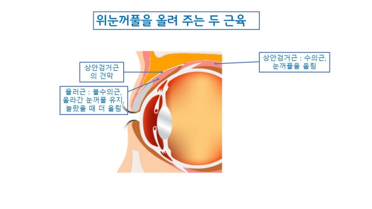  안검하수 눈매교정 근육 "상안검거근, 뮬러근"에 대해 제대로 알기