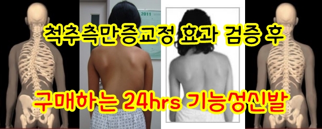 [척추측만증교정]효과 검증시켜주는 기능성신발 보셨나요?