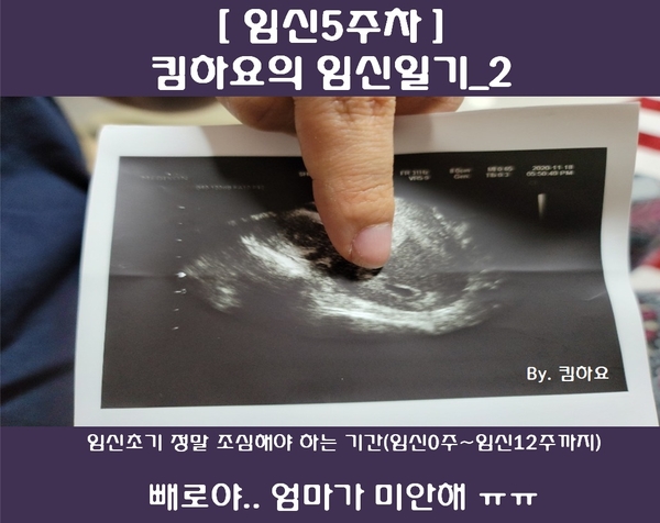  [임신5주차_임신일기] 임신초기 유산에 주의하세요! 빼로야..엄마가 미안해ㅠㅠ