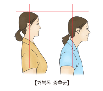  수건을 이용해서 거북목 교정을 해보자!
