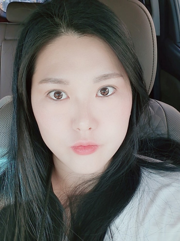  삼성서울병원 결과 선항암/ 림프절조직검사결과