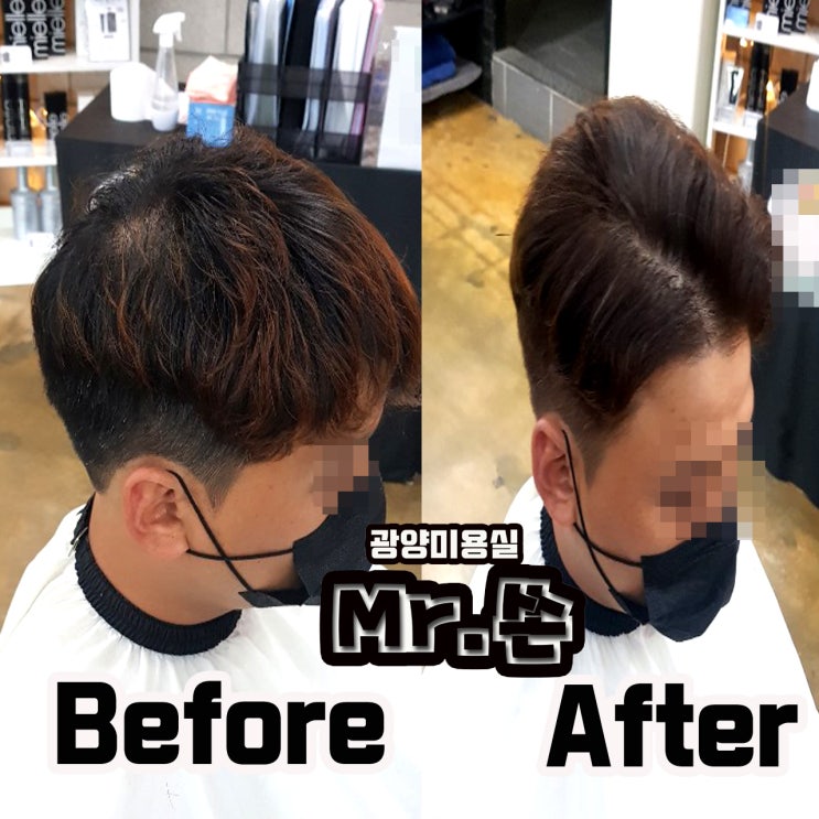  간단 모류교정으로 핸섬남 변신 ! !