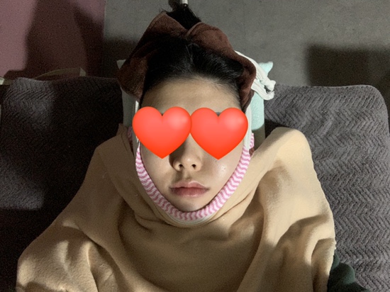  홍대피부관리 비대칭관리 ppc밴딩 후기 @홍대뷰티클럽