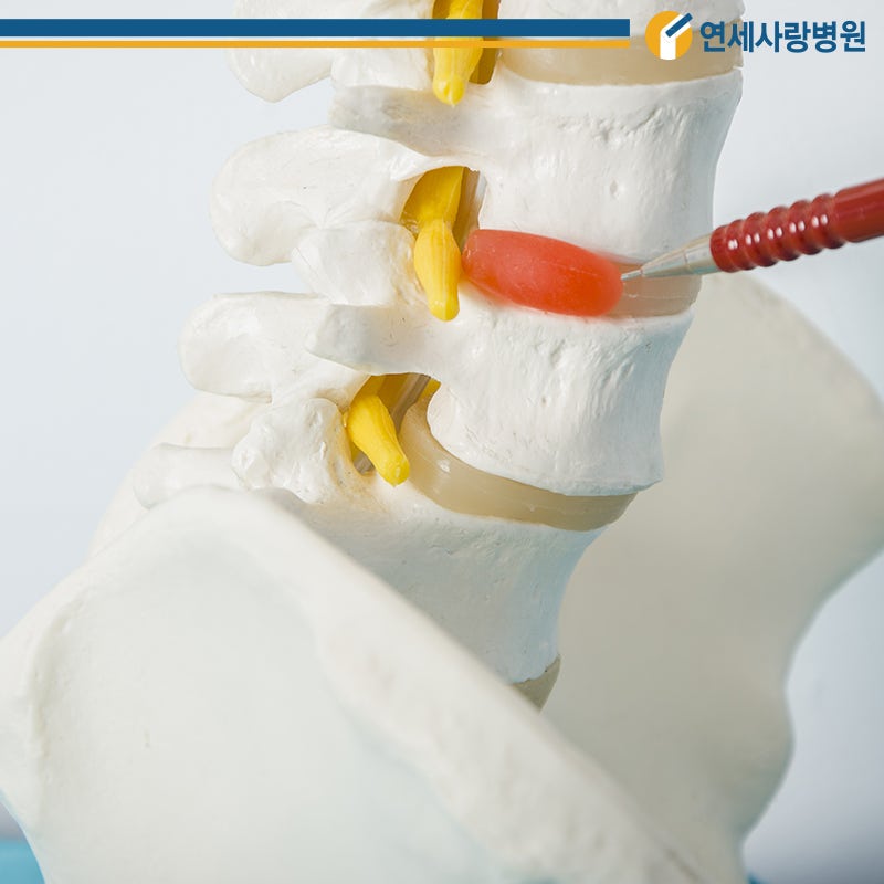 추간판탈출증, 척추병원에서는 허리통증치료 어떻게? 3