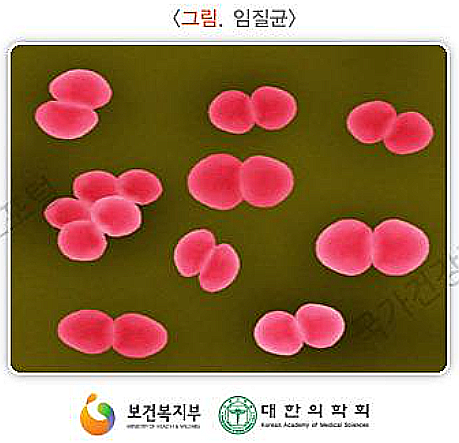 임균성 요도염, 임질, 증상과 치료, 예방 : 네이버 블로그