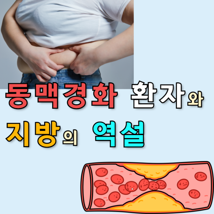 동맥경화 환자 - 1시간 30분 진료 후 진료비는 '0'원(feat. 비만의 역설)