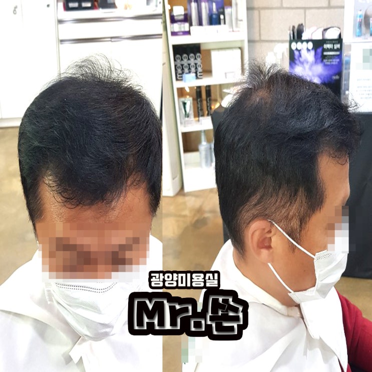  머리가 비어보이는지 모르고 살아오신 아버님 ! 미스터쏜에서 힐링 하셨습니다 !