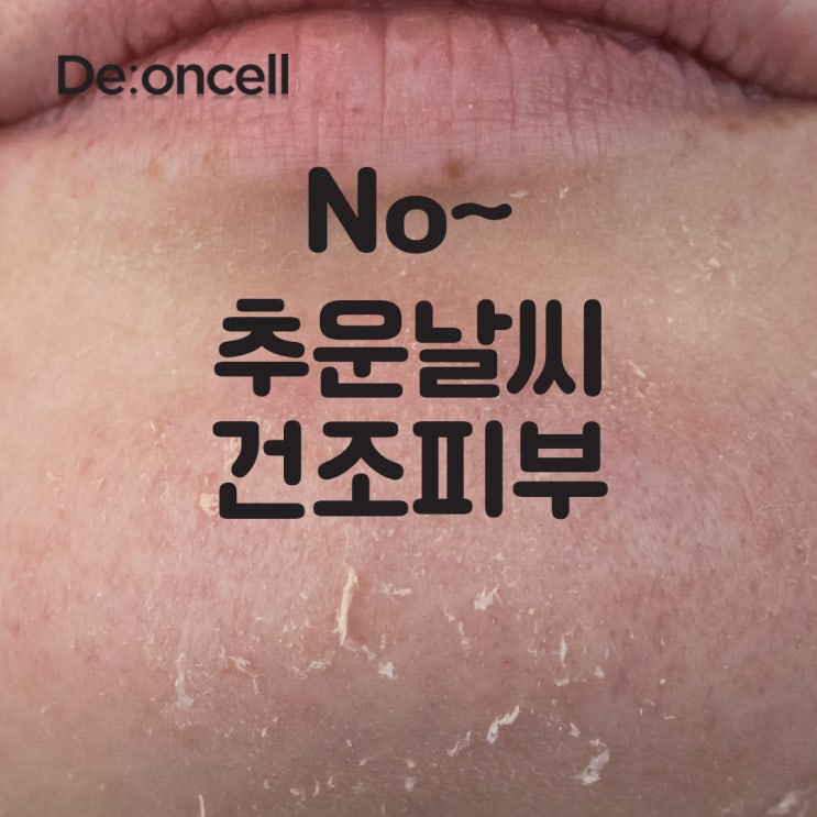  추운겨울시작! 디온셀 SC-DNA 더마 부스트 포 프로페셔널 솔루션