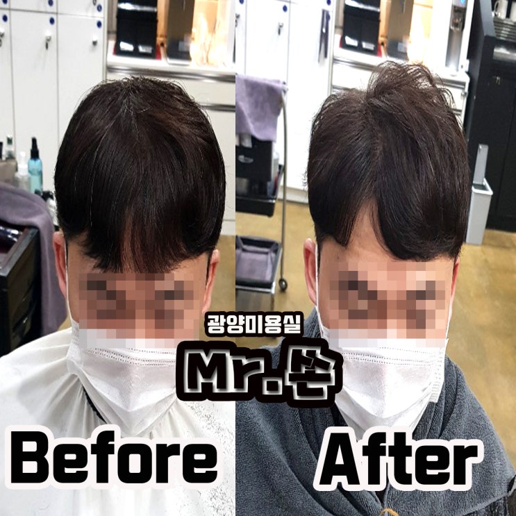  탈모커버 어렵지 않습니다 딱히 손질 안하셔두 되요~
