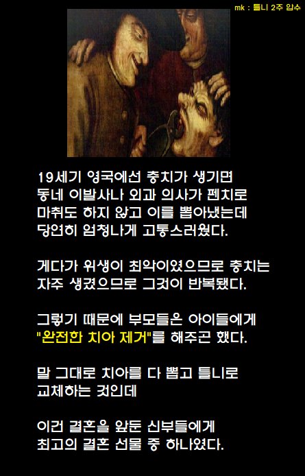  19세기식 충치 완벽 치료법