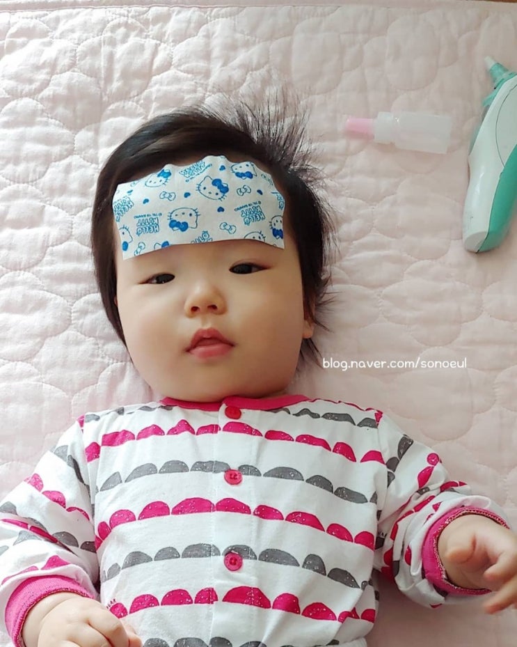  첫 감기 증상 (생후 165일째, 5개월 아가)